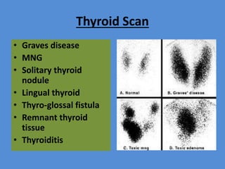 Thyroid Scan
• Graves disease
• MNG
• Solitary thyroid
nodule
• Lingual thyroid
• Thyro-glossal fistula
• Remnant thyroid
tissue
• Thyroiditis
 
