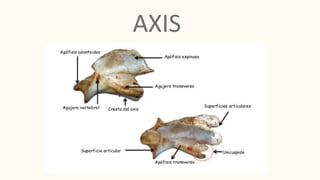 AXIS
 