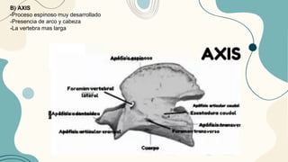 B) AXIS
-Proceso espinoso muy desarrollado
-Presencia de arco y cabeza
-La vertebra mas larga
 