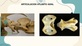 ARTICULACION ATLANTO AXIAL
 