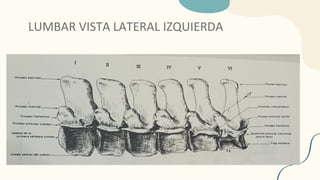 LUMBAR VISTA LATERAL IZQUIERDA
 