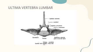 ULTIMA VERTEBRA LUMBAR
 