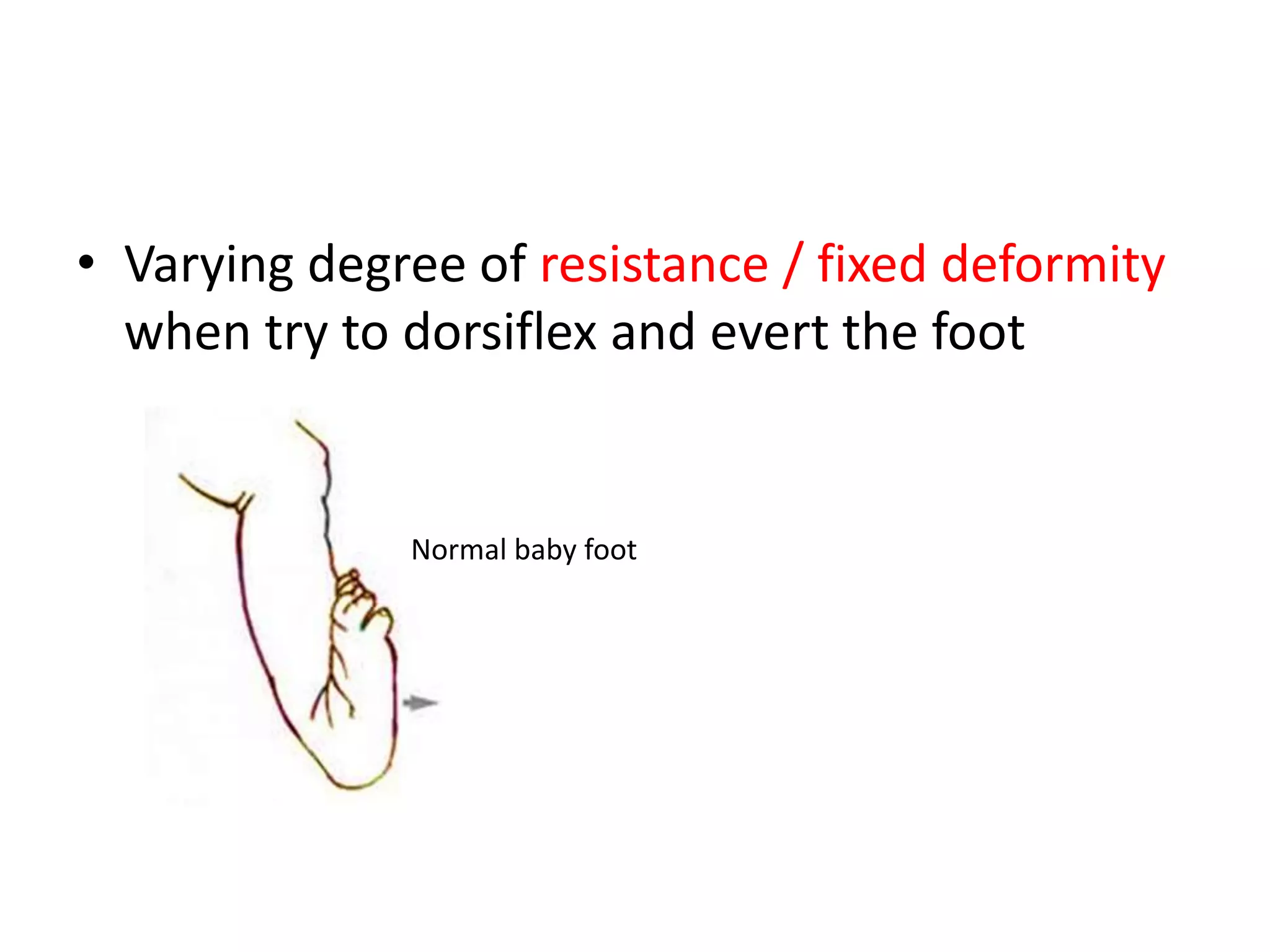 The Latest Advances In Equino Varus Treatment: Are They Right For You? - n5gf644