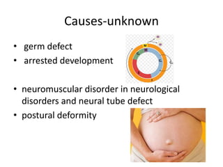 Causes-unknown
• germ defect
• arrested development
• neuromuscular disorder in neurological
disorders and neural tube def...