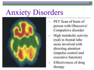Anxiety Disorders
 PET Scan of brain of
person with Obsessive/
Compulsive disorder
 High metabolic activity
(red) in frontal lobe
areas involved with
directing attention
(impulse control and
executive function)
 Effectiveness of drug
therapy
 