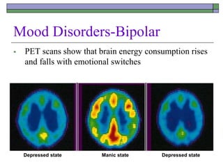 Mood Disorders-Bipolar
 PET scans show that brain energy consumption rises
and falls with emotional switches
Depressed state Manic state Depressed state
 