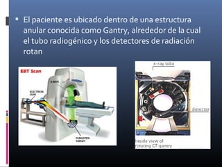  El paciente es ubicado dentro de una estructura
anular conocida como Gantry, alrededor de la cual
el tubo radiogénico y los detectores de radiación
rotan
 
