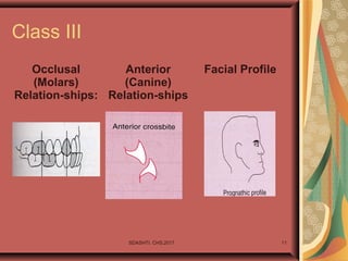 SDASHTI. CHS,2017 11
Class III
Occlusal
(Molars)
Relation-ships:
Anterior
(Canine)
Relation-ships
Facial Profile
 