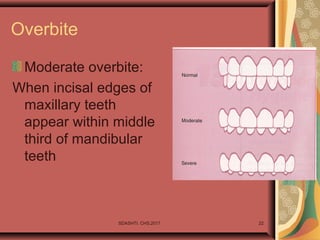 Overbite
Moderate overbite:
When incisal edges of
maxillary teeth
appear within middle
third of mandibular
teeth
SDASHTI. CHS,2017 22
 