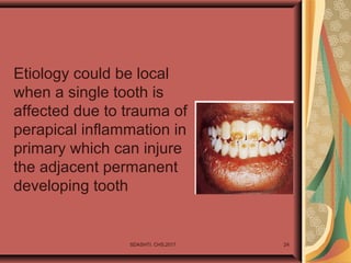 Etiology could be local
when a single tooth is
affected due to trauma of
perapical inflammation in
primary which can injure
the adjacent permanent
developing tooth
SDASHTI. CHS,2017 24
 