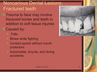 SDASHTI. CHS,2017 31
Noncarious Dental Lesions:
Fractured teeth
Trauma to face may involve
fractured bones and teeth in
addition to soft tissue injuries
Caused by:
Falls
Blows while fighting
Contact sports without mouth
protectors
Automobile, bicycle, and diving
accidents
 