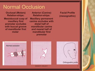SDASHTI. CHS,2017 7
Normal Occlusion
Occlusal (Molars)
Relation-ships:
Mesiobuccal cusp of
maxillary first
premolar occludes
with buccal groove
of mandibular first
molar
Anterior (Canine)
Relation-ships:
Maxillary permanent
canine occludes with
distal half of
mandibular canine
and mesial half of
mandibular first
premolar
Facial Profile
(mesognathic)
 