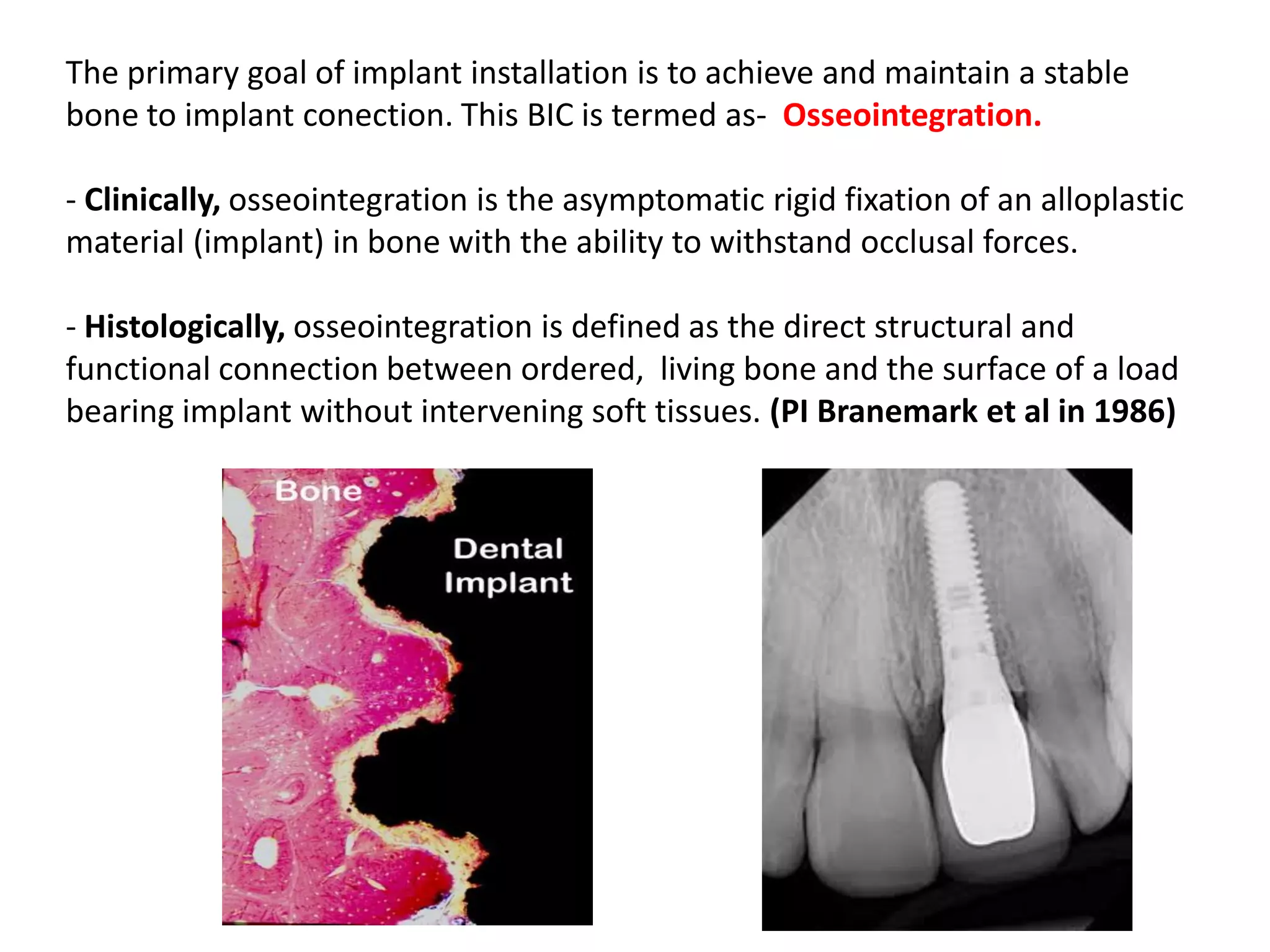 Introduction to Dental Implants | PDF