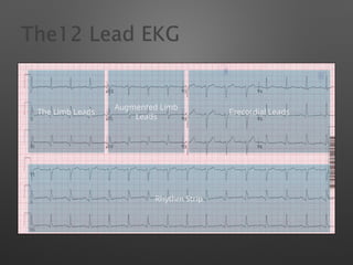 History and Introduction to EKGs in Clinical Medicine | PPTX