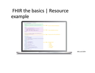 FHIR the basics | Resource
example
Resource Identity & Metadata
Human Readable Summary
Extension with URL to definition
Standard Data:
• MRN
• Name
• Gender
• Birth Date
• Provider
XML and JSON
 