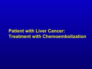 Patient with Liver Cancer:
Treatment with Chemoembolization

 
