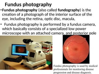 Fundus Microscope Intro to Medical Image Processinggg.pptx