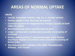 Introduction to Bone Scan: Techniques and Diagnosis | PPTX