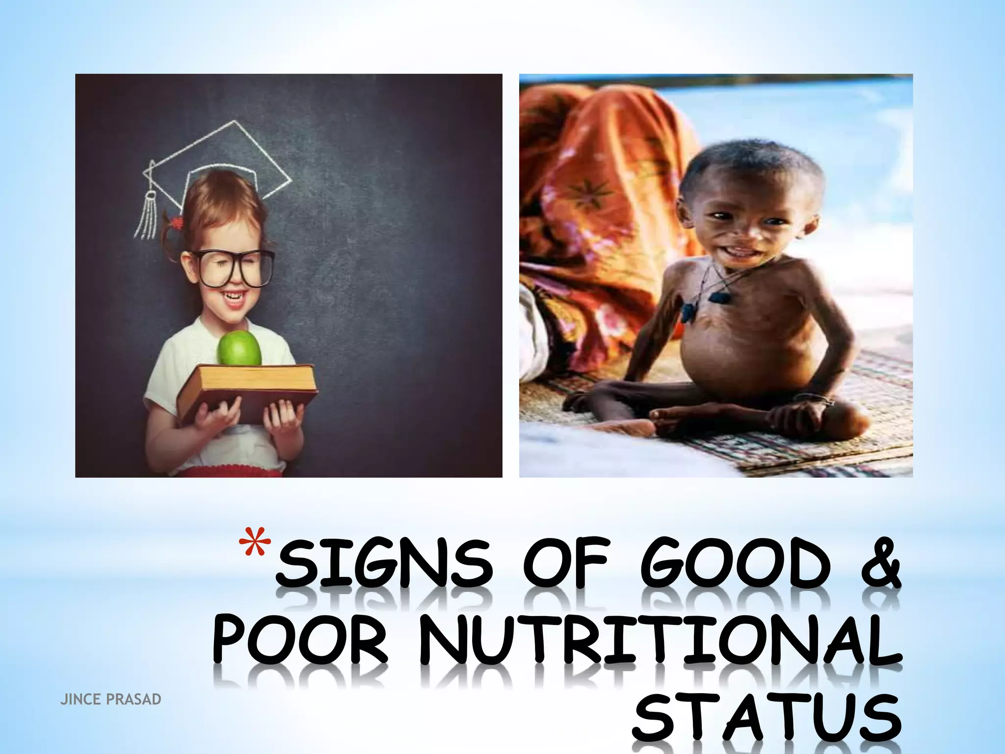 *SIGNS OF GOOD &
POOR NUTRITIONAL
STATUS
JINCE PRASAD
 