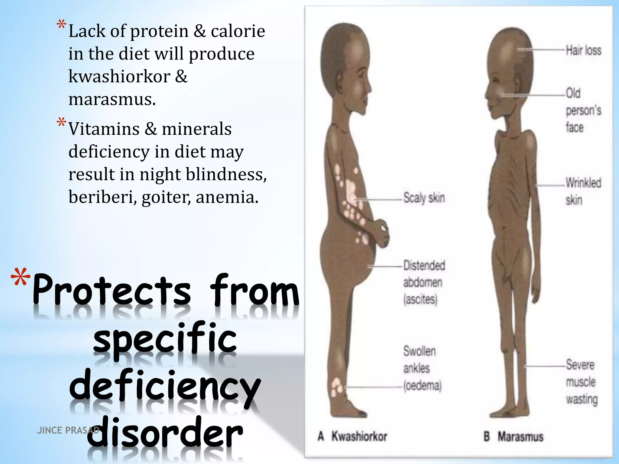 *Protects from
specific
deficiency
disorder
*Lack of protein & calorie
in the diet will produce
kwashiorkor &
marasmus.
*Vitamins & minerals
deficiency in diet may
result in night blindness,
beriberi, goiter, anemia.
JINCE PRASAD
 