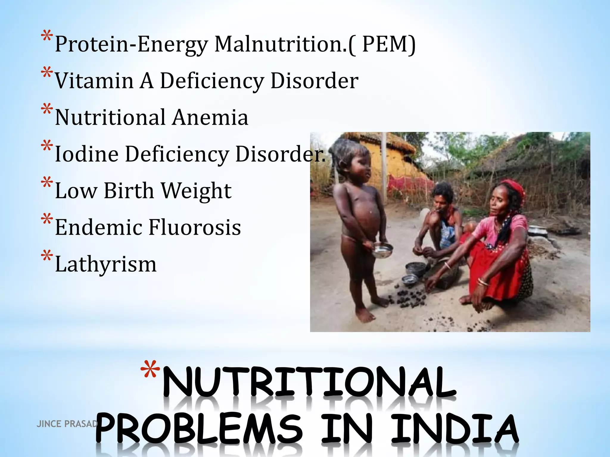 *NUTRITIONAL
PROBLEMS IN INDIA
*Protein-Energy Malnutrition.( PEM)
*Vitamin A Deficiency Disorder
*Nutritional Anemia
*Iodine Deficiency Disorder.
*Low Birth Weight
*Endemic Fluorosis
*Lathyrism
JINCE PRASAD
 