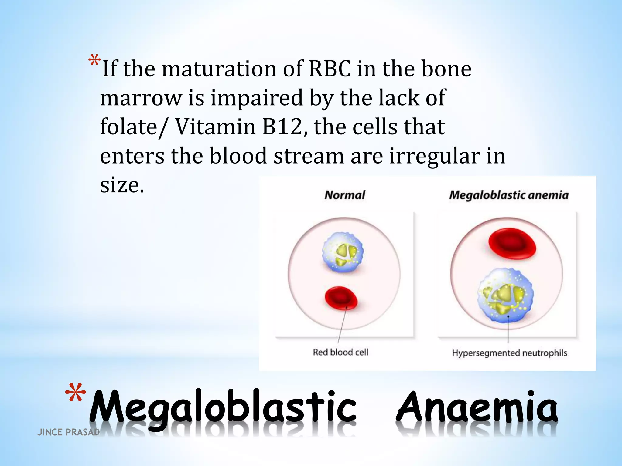 *Megaloblastic Anaemia
*If the maturation of RBC in the bone
marrow is impaired by the lack of
folate/ Vitamin B12, the cells that
enters the blood stream are irregular in
size.
JINCE PRASAD
 
