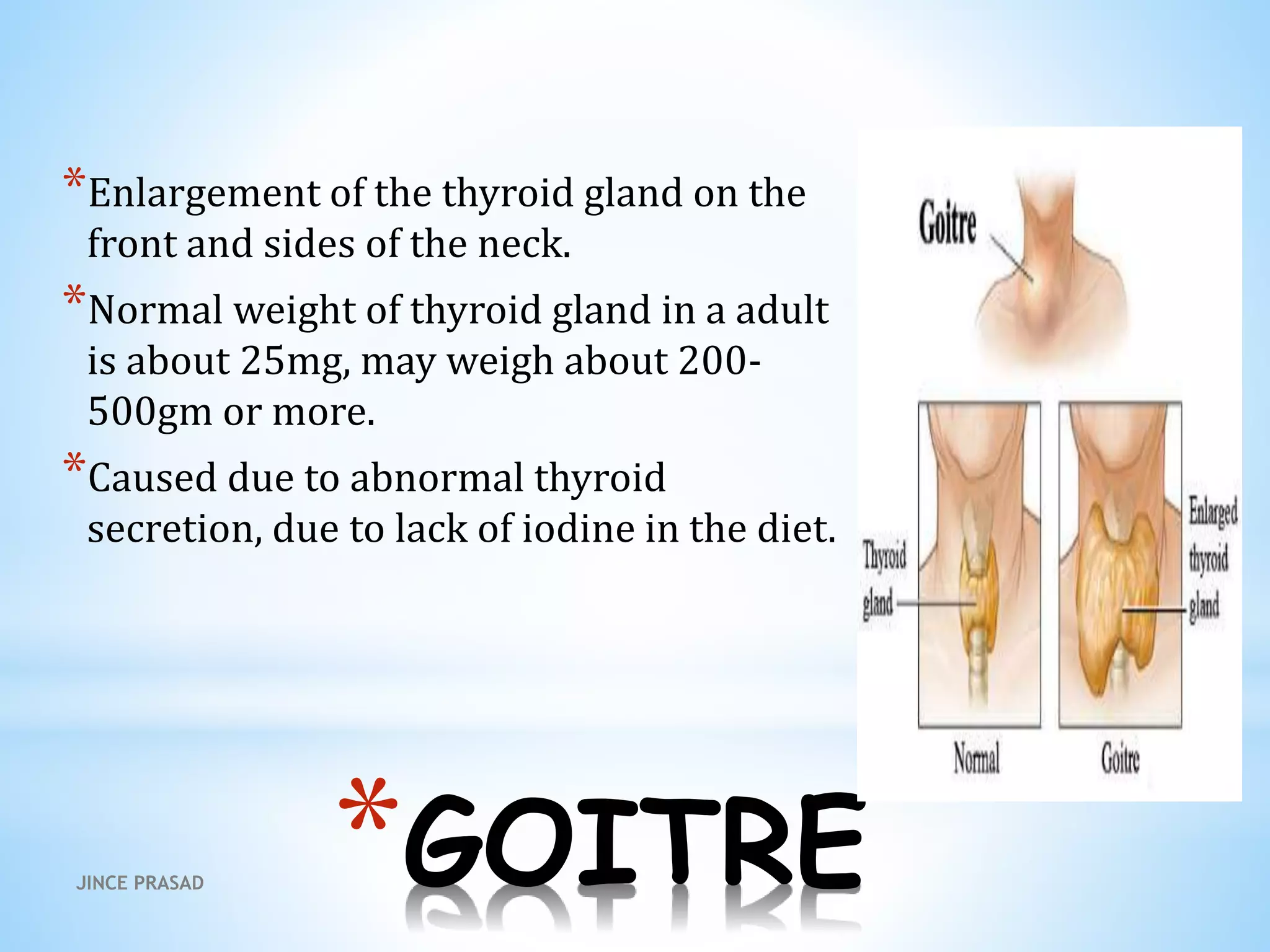 *GOITRE
*Enlargement of the thyroid gland on the
front and sides of the neck.
*Normal weight of thyroid gland in a adult
is about 25mg, may weigh about 200-
500gm or more.
*Caused due to abnormal thyroid
secretion, due to lack of iodine in the diet.
JINCE PRASAD
 