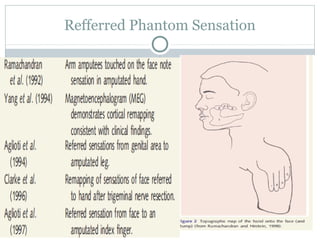 Refferred Phantom Sensation
 