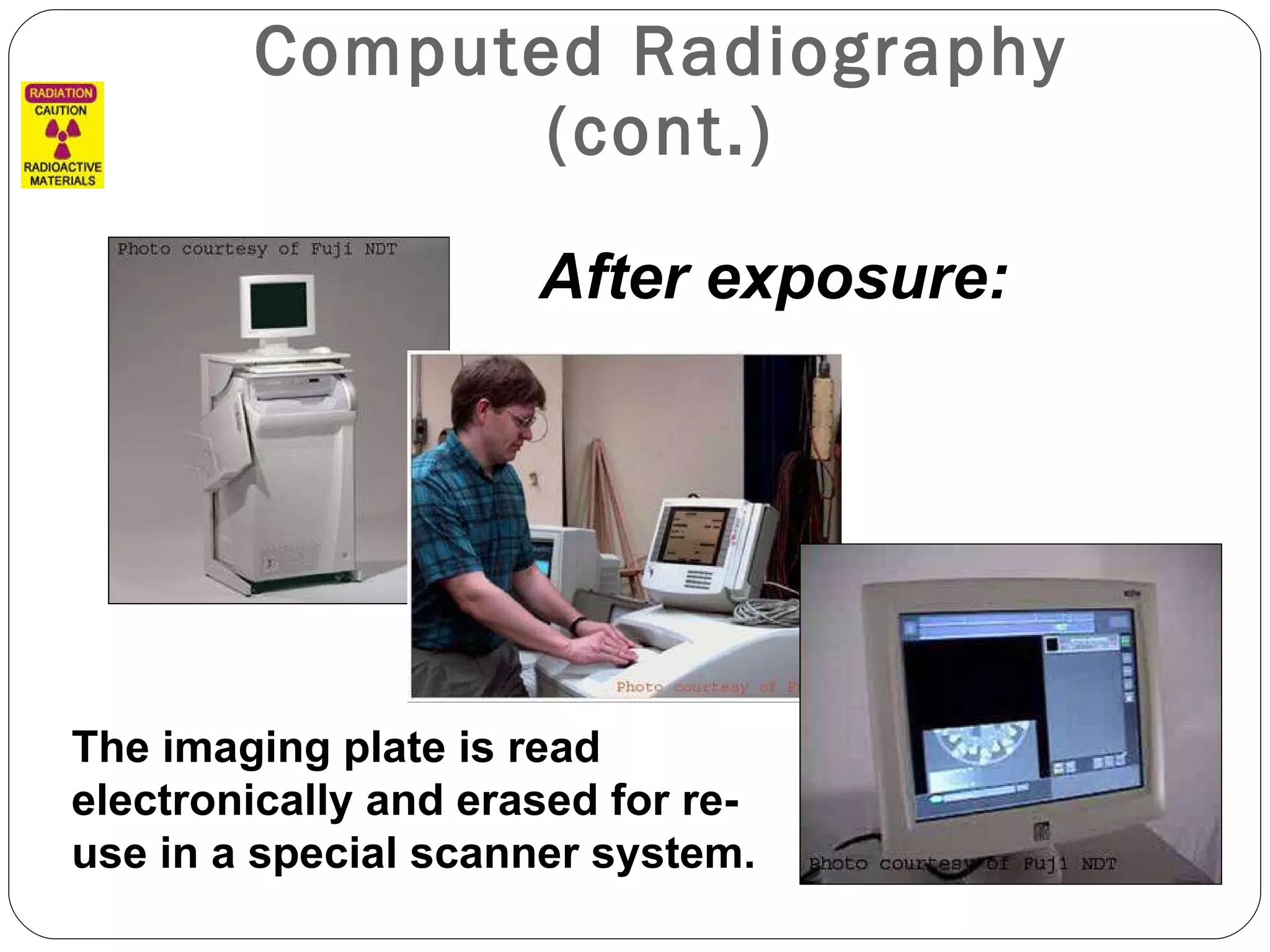 Computed Radiography (cont.) After exposure: The imaging plate is read electronically and erased for re-use in a special scanner system. 