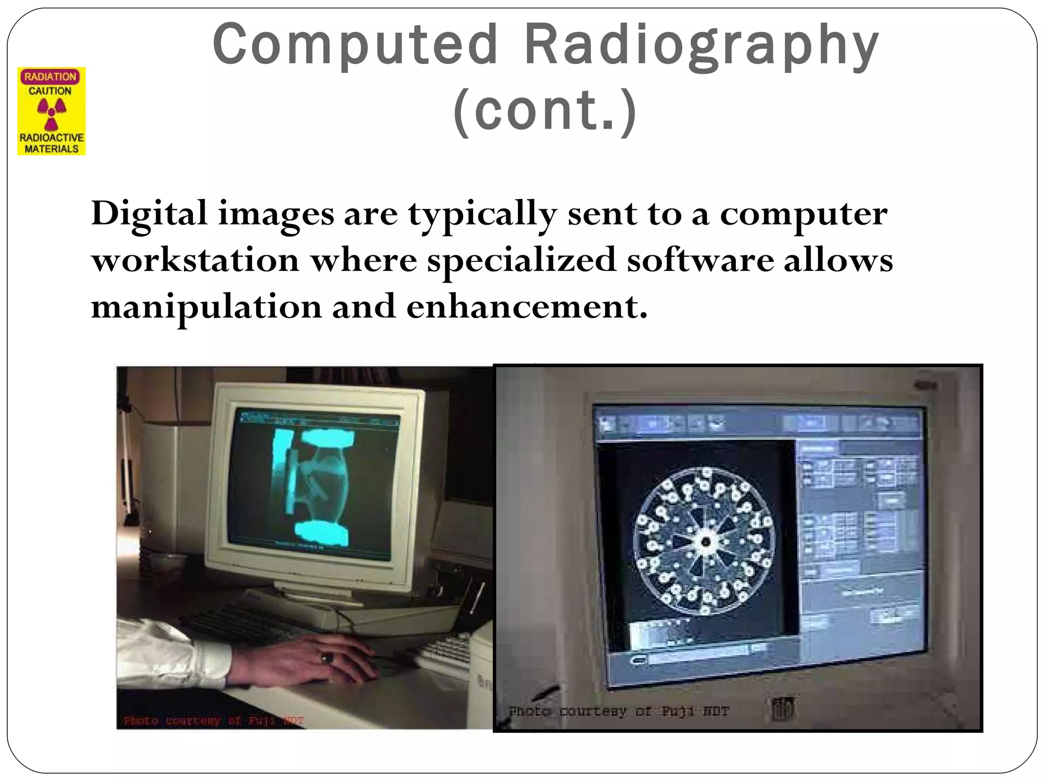 Computed Radiography (cont.) Digital images are typically sent to a computer workstation where specialized software allows manipulation and enhancement. 