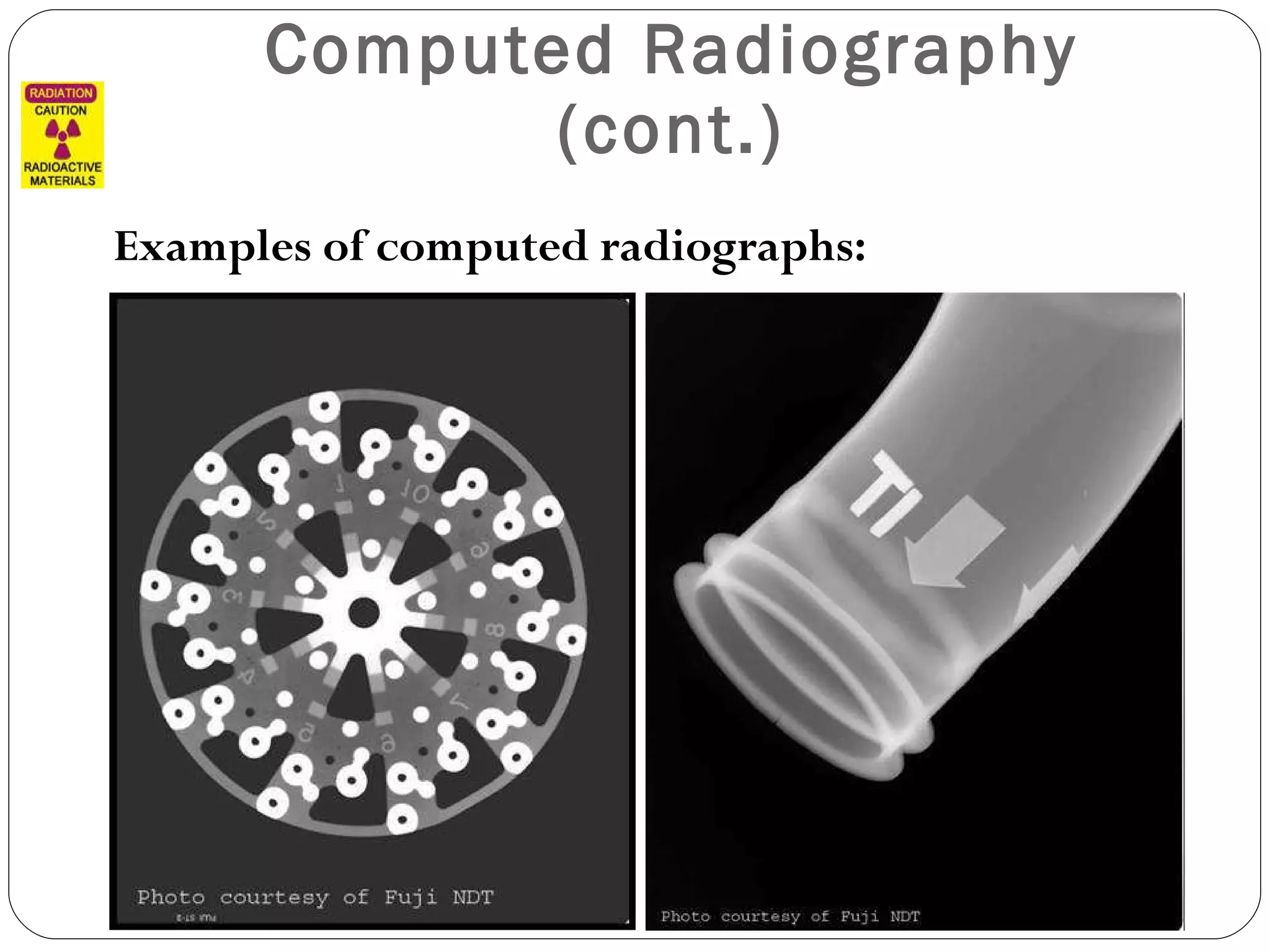 Computed Radiography (cont.) Examples of computed radiographs: 