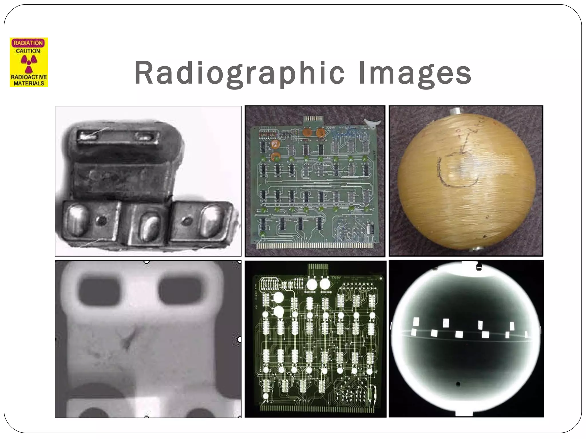Radiographic Images 