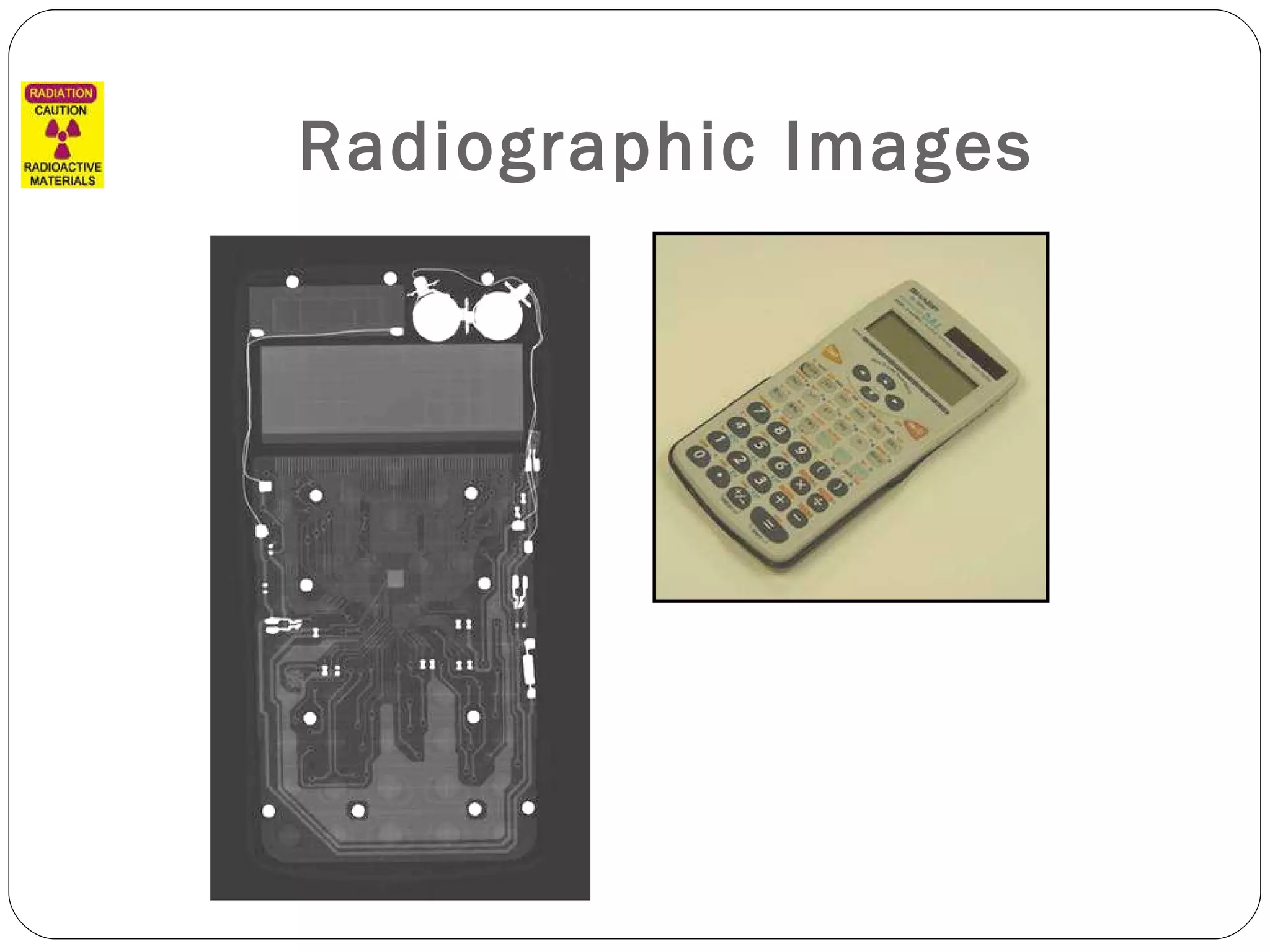 Radiographic Images 