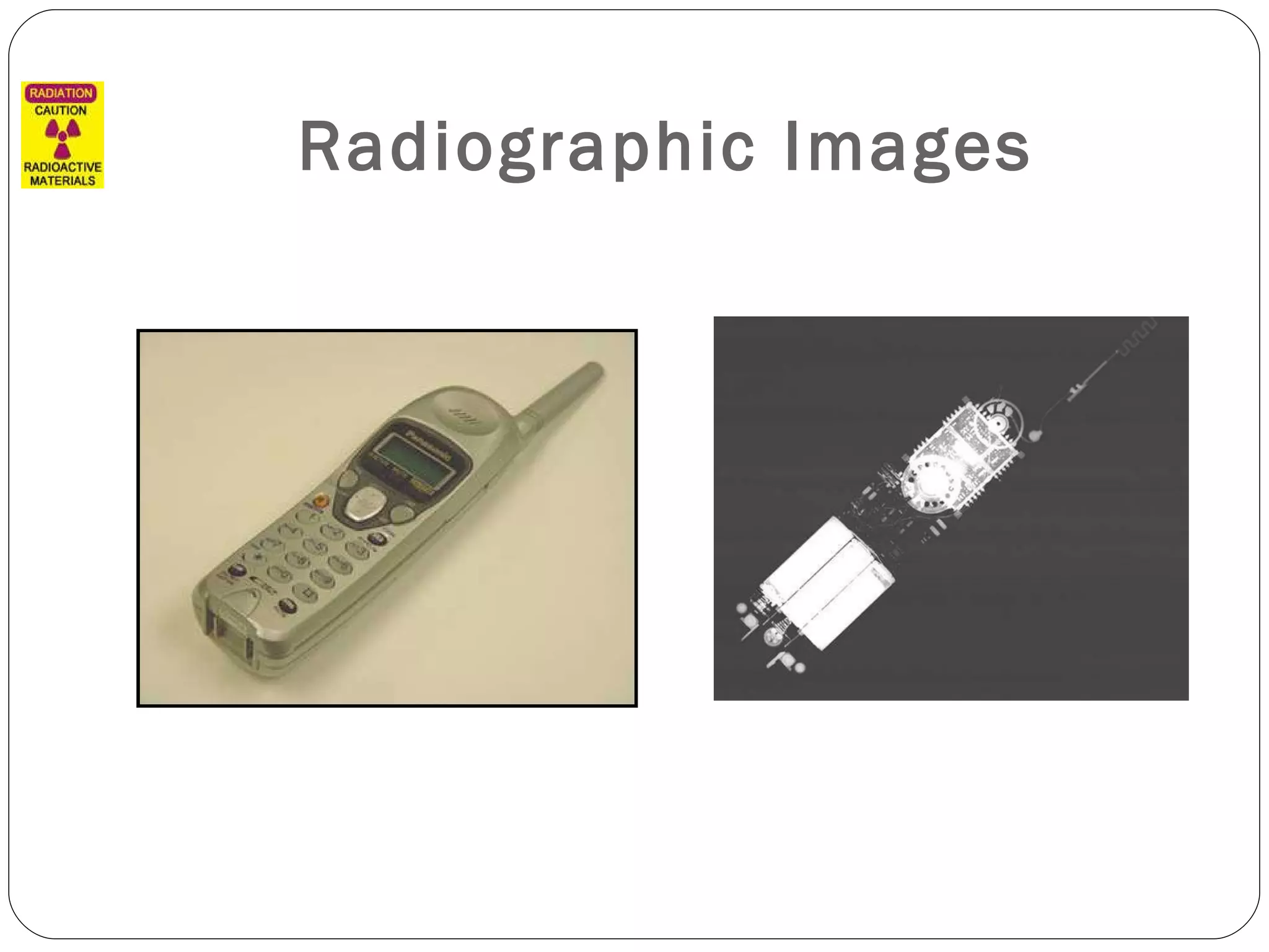 Radiographic Images 
