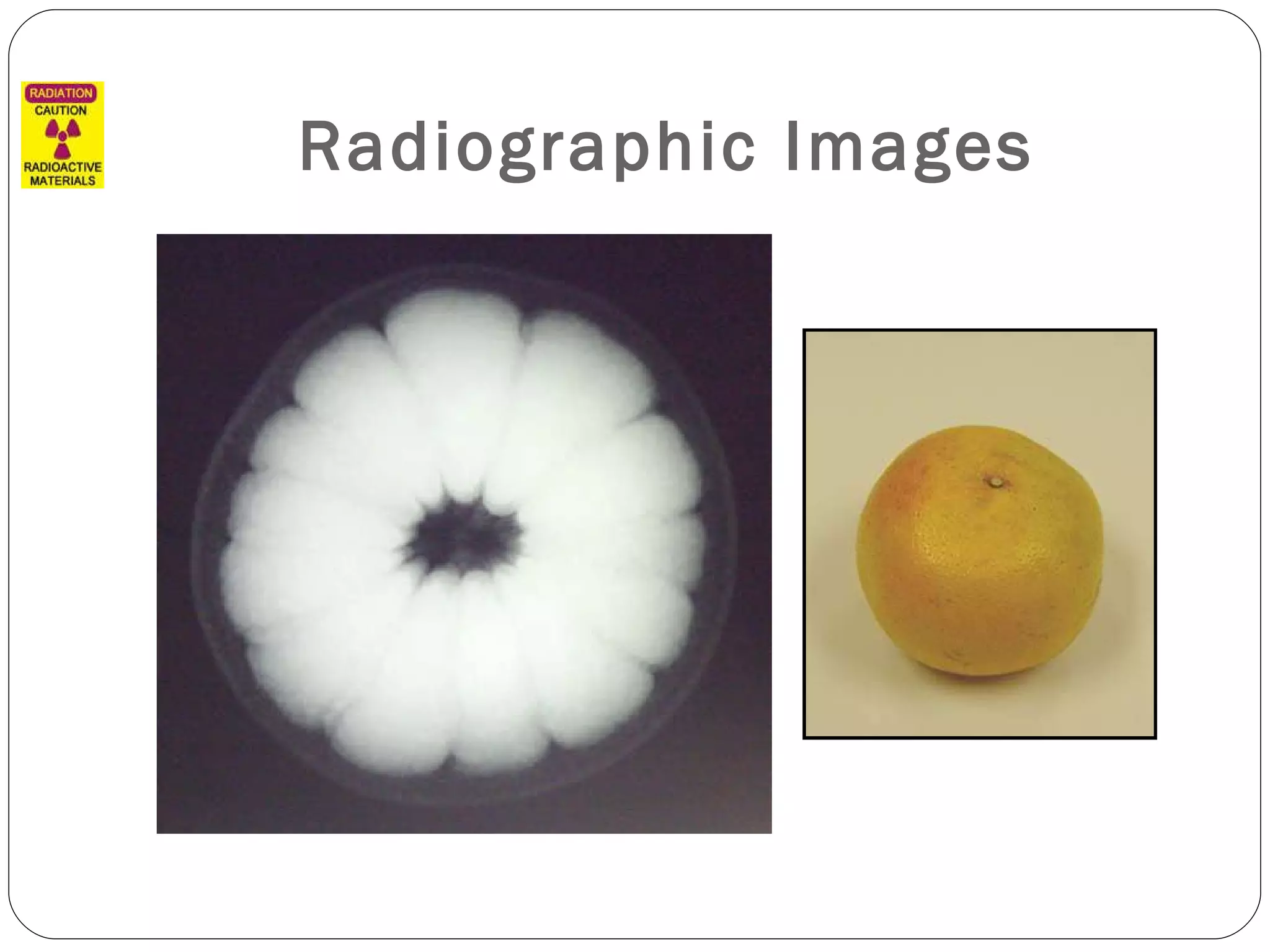 Radiographic Images 