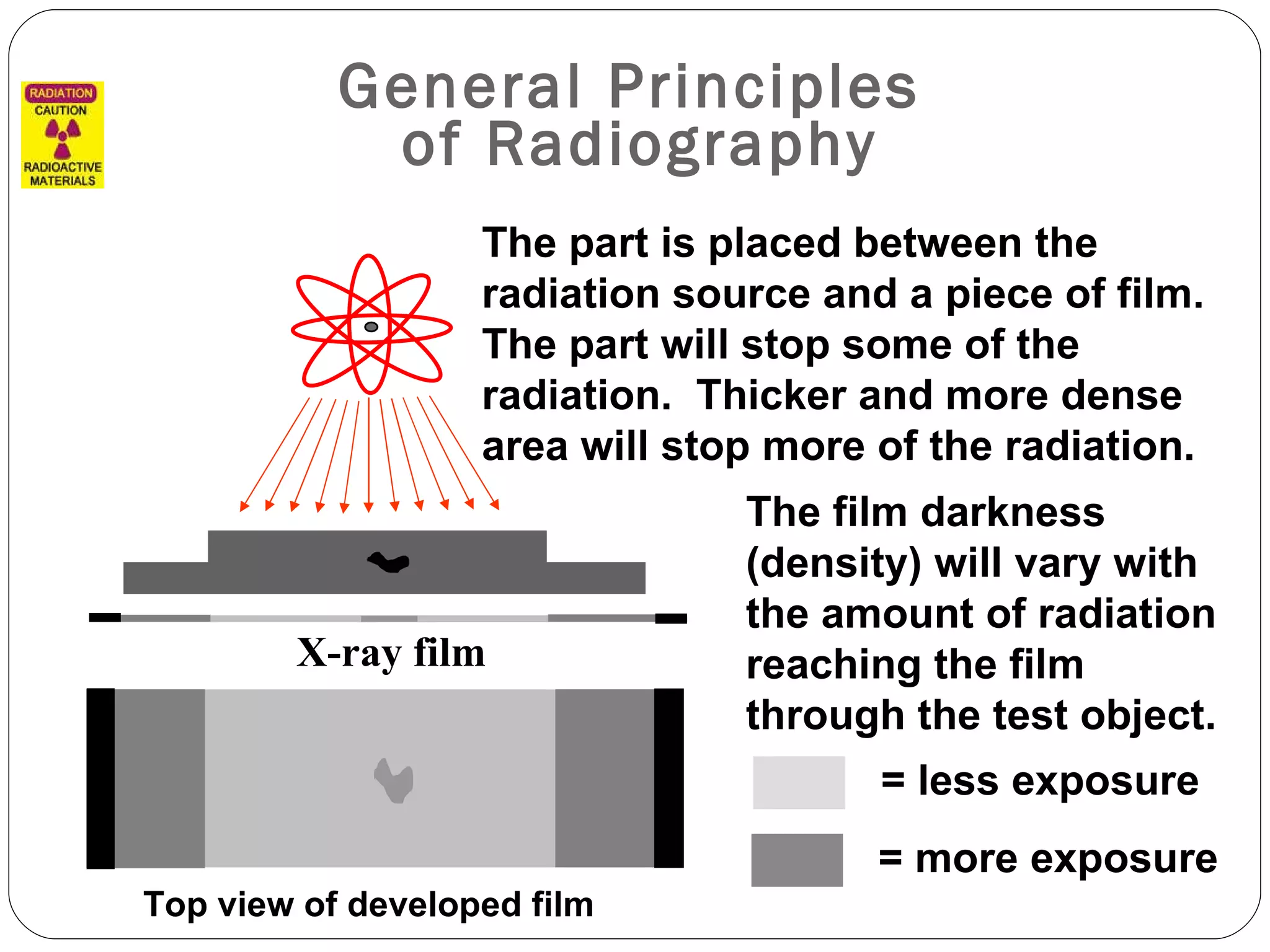 General Principles  of Radiography Top view of developed film   X-ray film The film darkness (density) will vary with the amount of radiation reaching the film through the test object. The part is placed between the radiation source and a piece of film.  The part will stop some of the radiation.  Thicker and more dense area will stop more of the radiation.  = more exposure = less exposure 