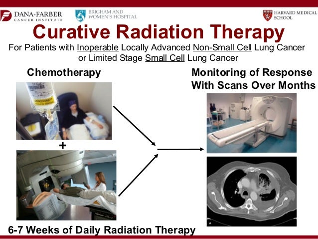 how-is-radiation-therapy-used-to-help-lung-cancer-patients