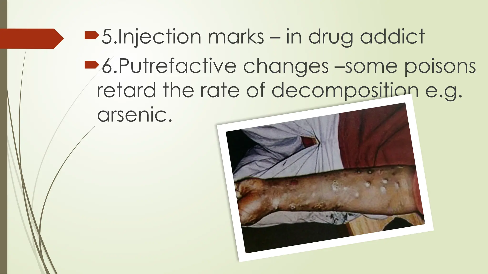 5.Injection marks – in drug addict
6.Putrefactive changes –some poisons
retard the rate of decomposition e.g.
arsenic.
 