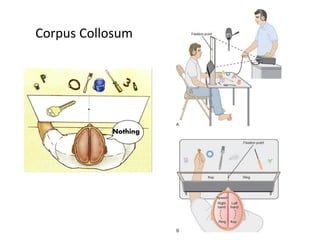 Nothing
Corpus Collosum
 