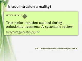 Is true intrusion a reality?
Am J Orthod Dentofacial Orthop 2006;130:709-14
 