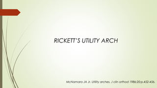 RICKETT’S UTILITY ARCH
McNamara JA Jr. Utility arches. J clin orthod 1986;20:p.452-456.
 