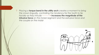  Placing a torque bend in the utility arch creates a moment to bring
the crown lingually, controlling the tendency for the tooth to tip
facially as they intrude increases the magnitude of the
intrusive force on the incisor segment and the extrusive force and
the couple on the molar
 