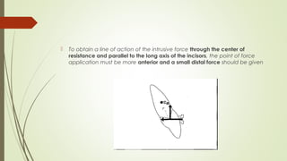  To obtain a line of action of the intrusive force through the center of
resistance and parallel to the long axis of the incisors, the point of force
application must be more anterior and a small distal force should be given
 