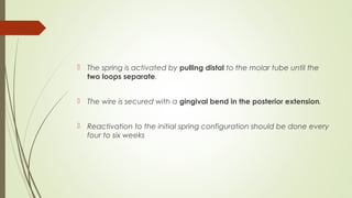  The spring is activated by pulling distal to the molar tube until the
two loops separate.
 The wire is secured with a gingival bend in the posterior extension.
 Reactivation to the initial spring configuration should be done every
four to six weeks
 