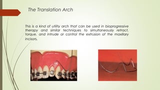 The Translation Arch
This is a kind of utility arch that can be used in bioprogressive
therapy and similar techniques to simultaneously retract,
torque, and intrude or control the extrusion of the maxillary
incisors.
 