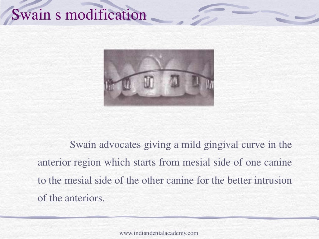 Intrusion mechanic and appliances /certified fixed orthodontic course…