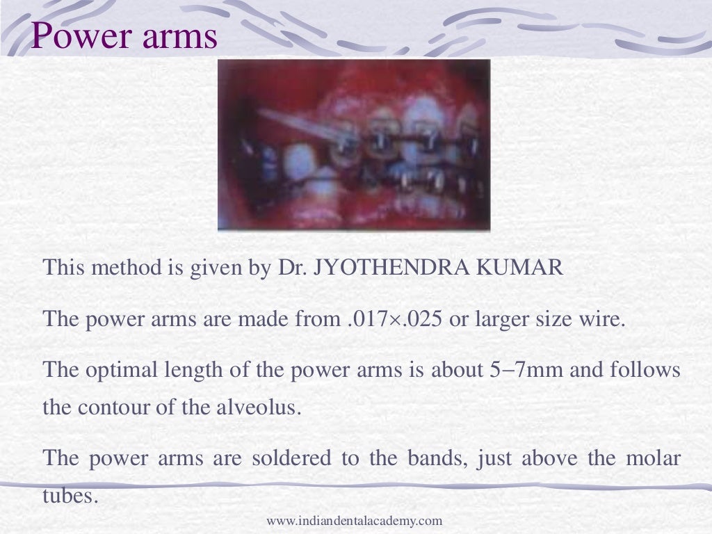 Intrusion mechanic and appliances /certified fixed orthodontic course…