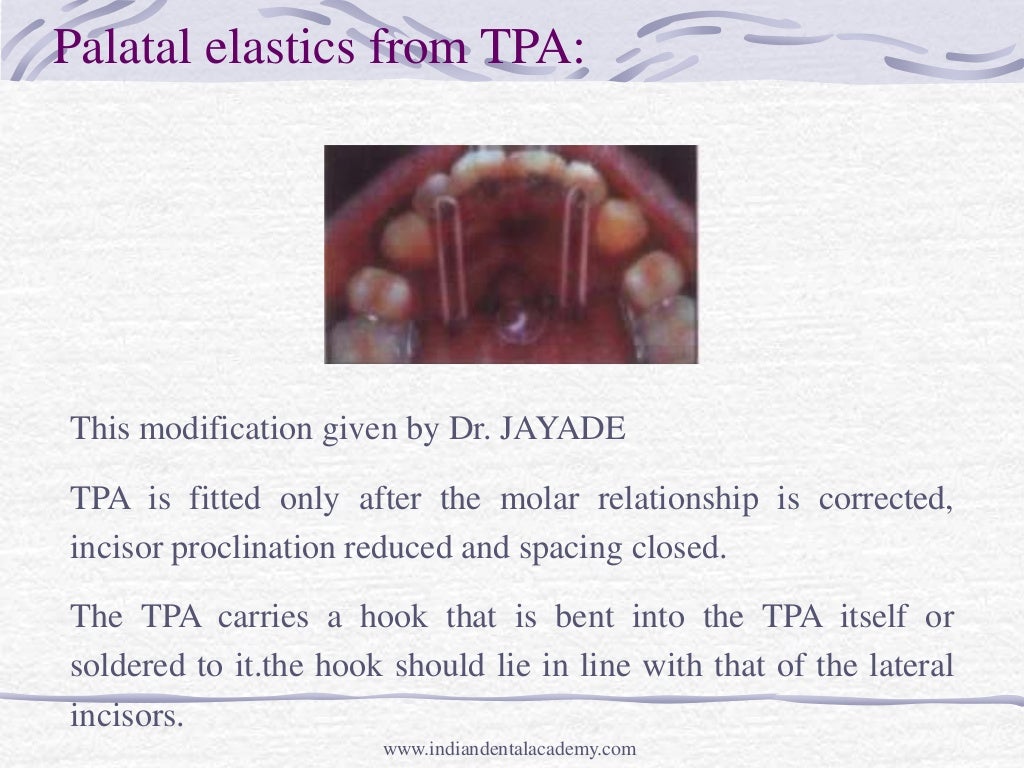 Intrusion mechanic and appliances /certified fixed orthodontic course…