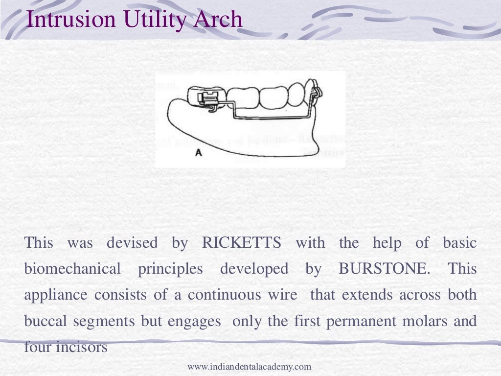 Intrusion mechanic and appliances /certified fixed orthodontic course…