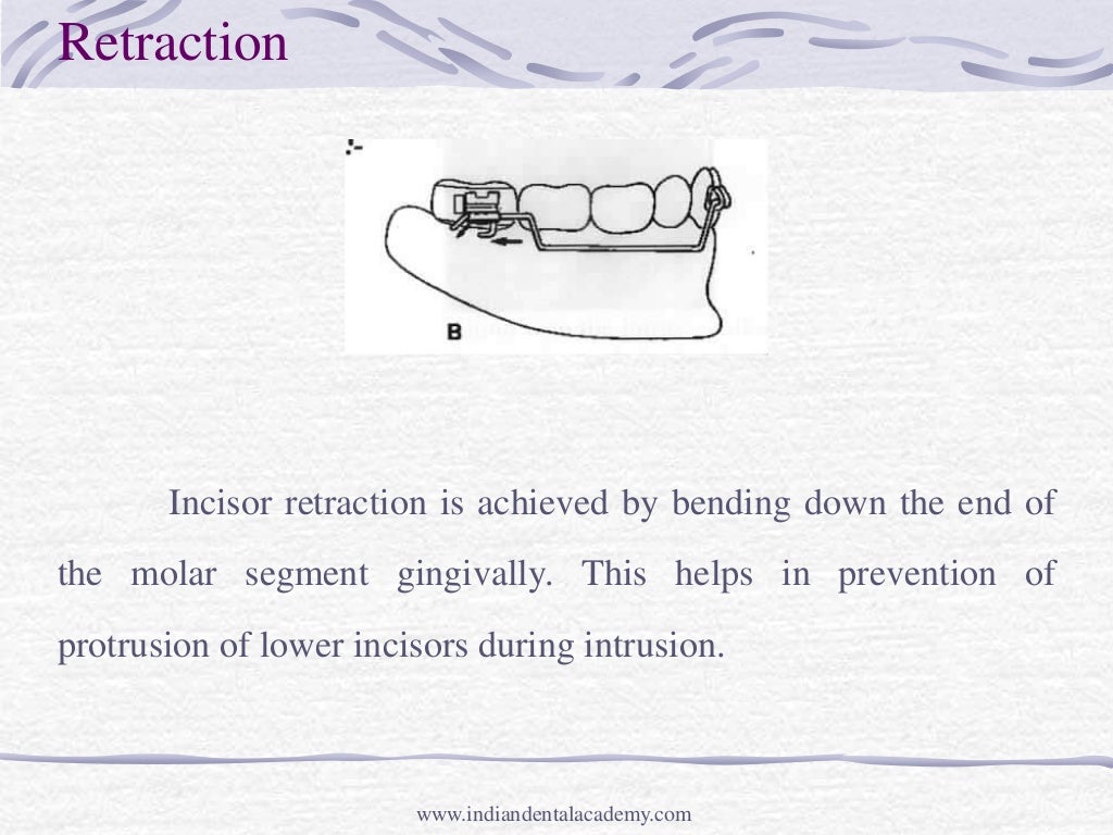 Intrusion mechanic and appliances /certified fixed orthodontic course…